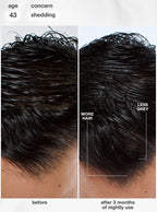 K18 FutureIQ™ biomimetic hair longevity serum