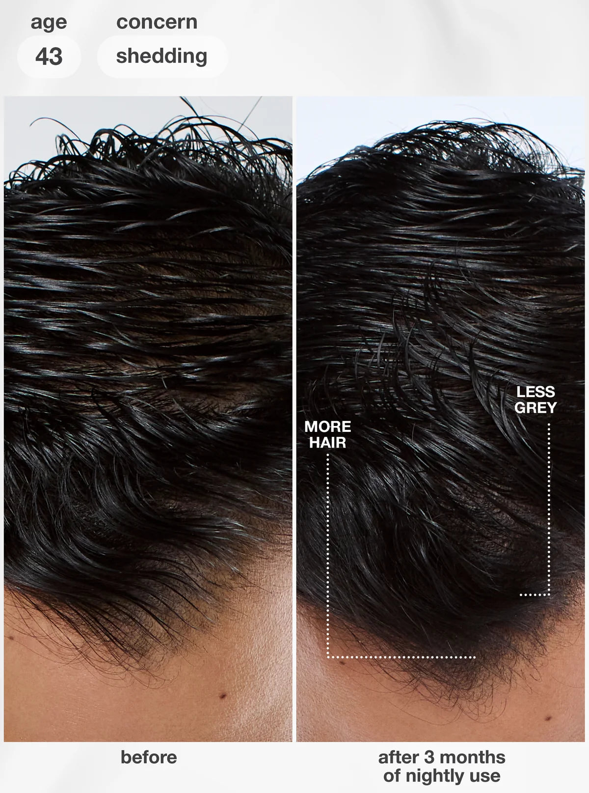 K18 FutureIQ™ biomimetic hair longevity serum