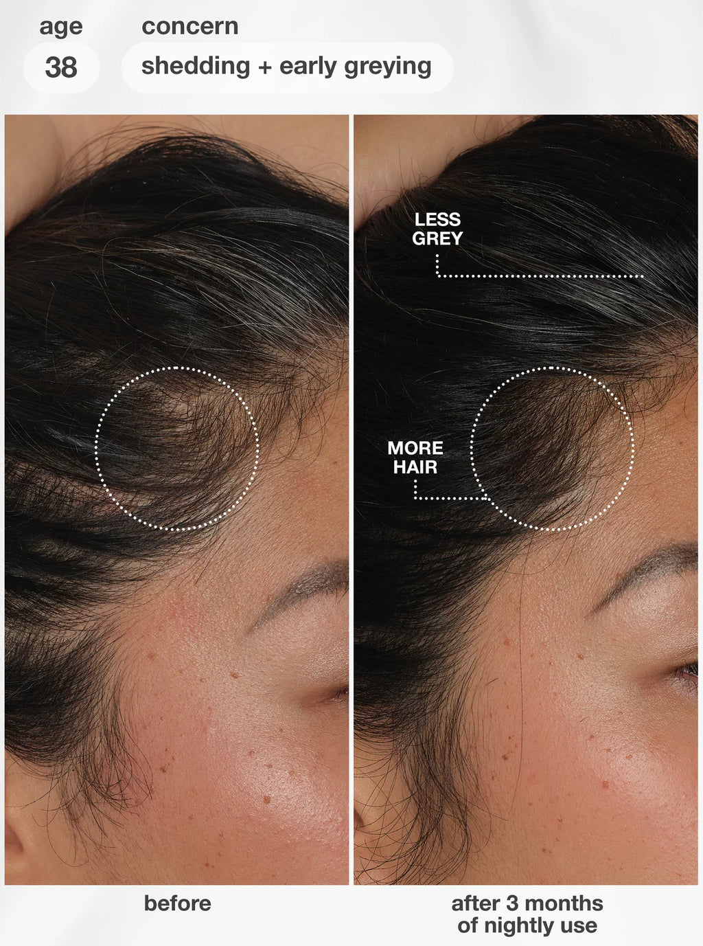 K18 FutureIQ™ biomimetic hair longevity serum