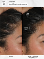 K18 FutureIQ™ biomimetic hair longevity serum