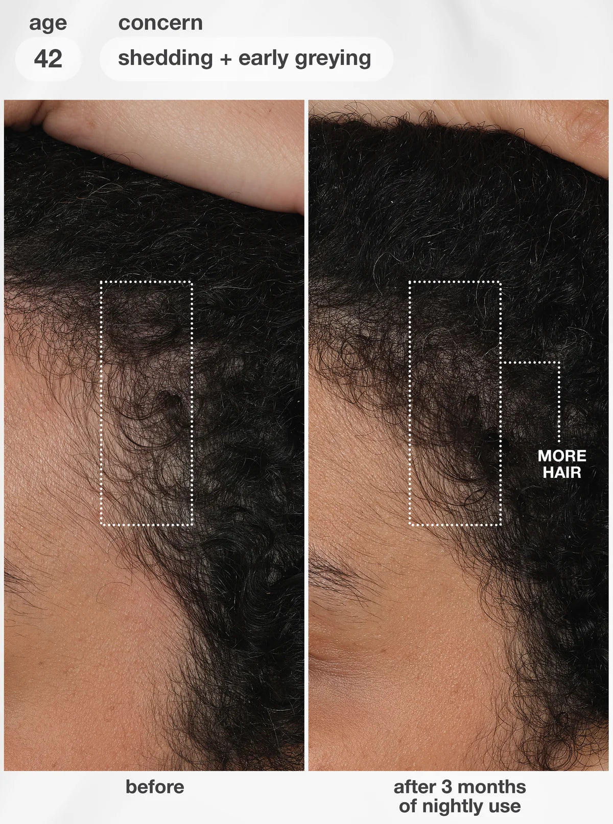 K18 FutureIQ™ biomimetic hair longevity serum