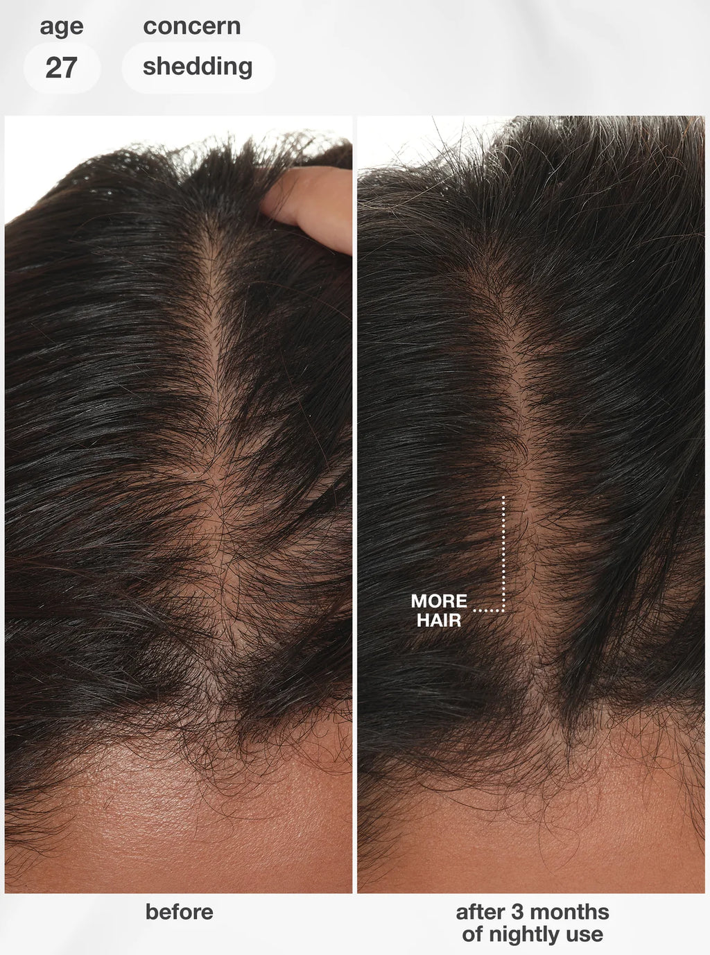 K18 FutureIQ™ biomimetic hair longevity serum