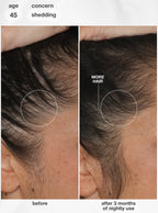 K18 FutureIQ™ biomimetic hair longevity serum