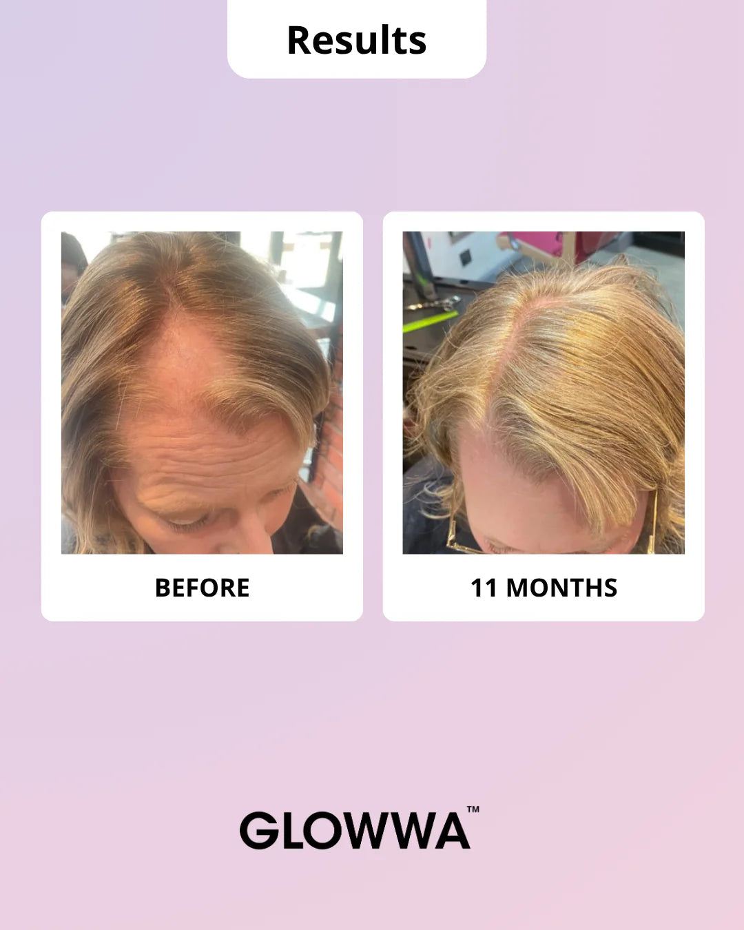 GLOWWA HAIR FOOD | MENO - 3 Month Supply