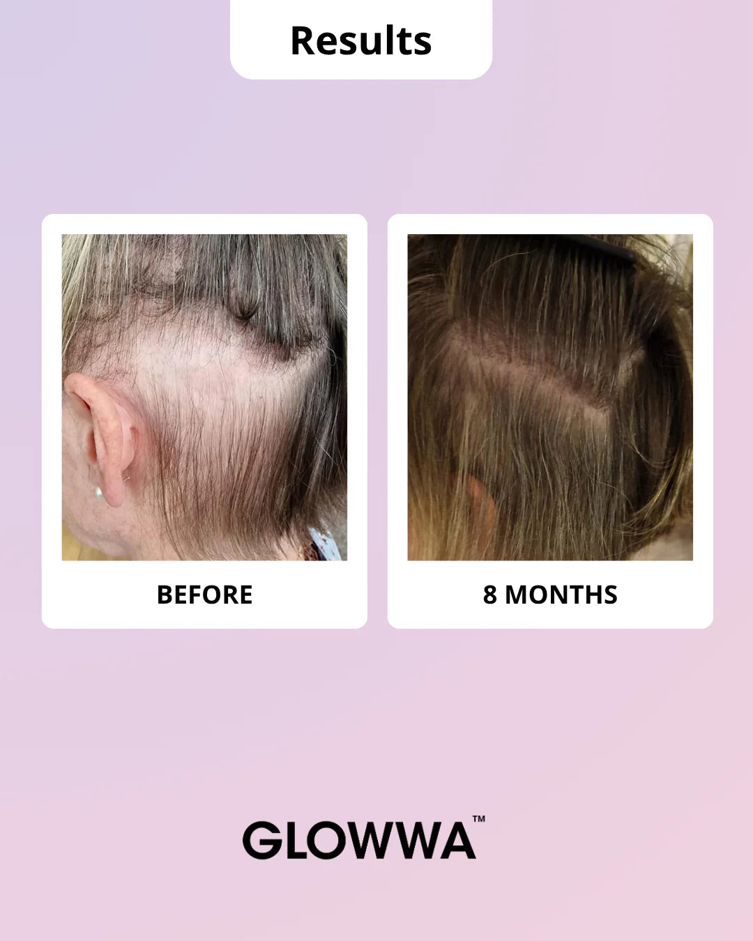 GLOWWA HAIR FOOD | MENO - 3 Month Supply