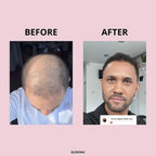 GLOWWA HAIR FOOD - 3 Month Supply