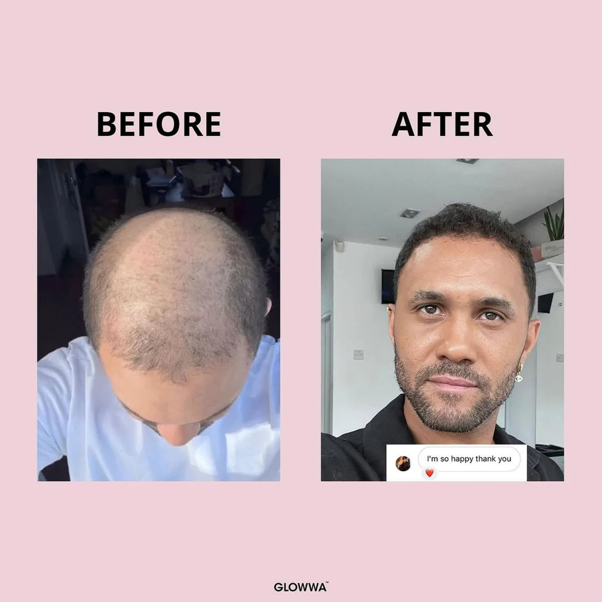 GLOWWA HAIR FOOD - 3 Month Supply