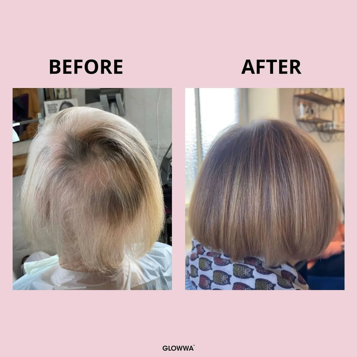 GLOWWA HAIR FOOD - 3 Month Supply